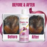 Onion Oil For Anti-Greying, Anti-Dandruff & Hair Fall Control- 200 ml